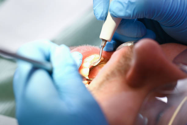 Best Broken or Chipped Tooth Repair in Bradley, IL